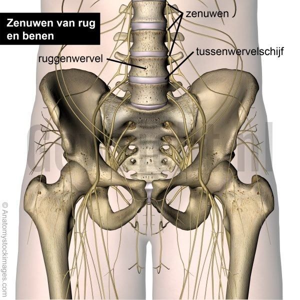 Lumbar_radicular_syndrome