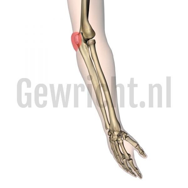 bursitis-olecrani(1)